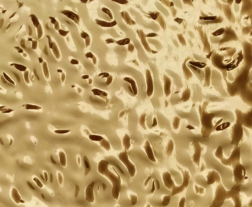  Relief gold