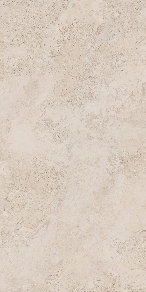  Navona Bone Gross Ret